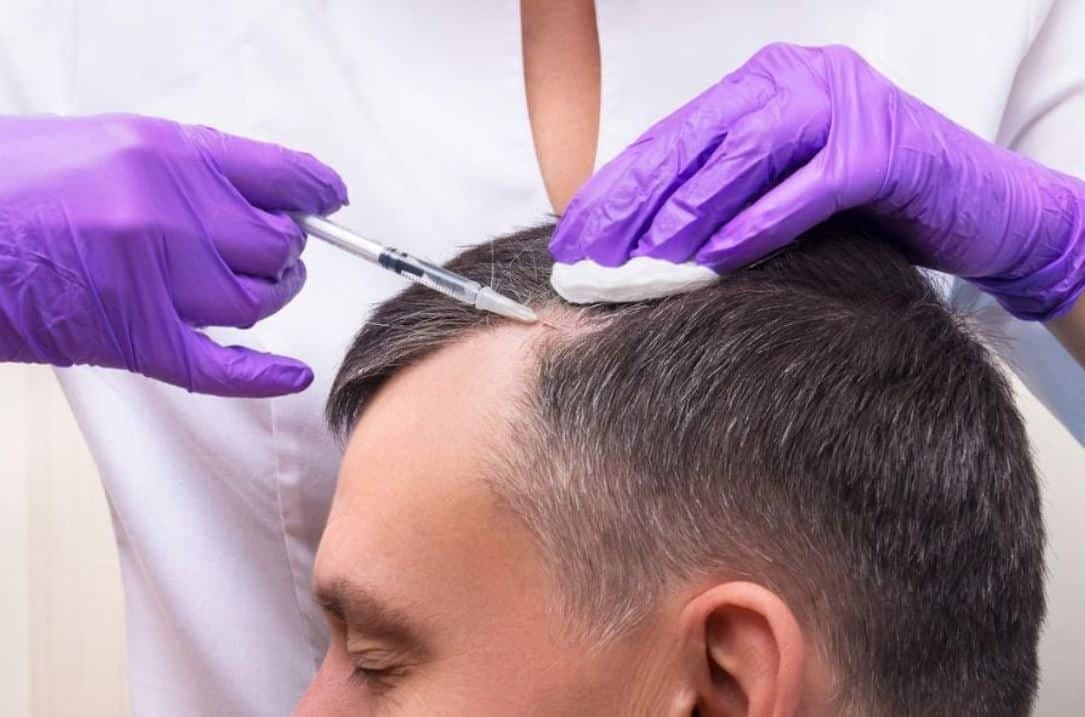 Hair Transplant London Clinic – Award-Winning Team in Harley Street