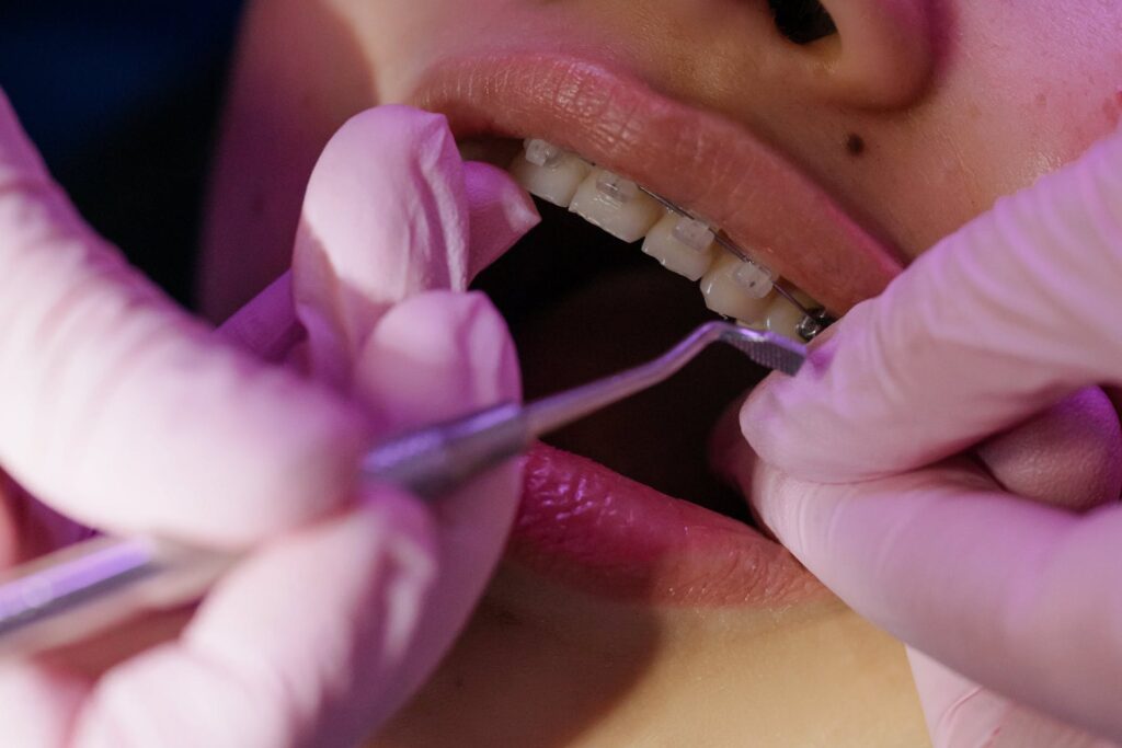 Transform Your Smile with Expert Orthodontics Edmonton Services